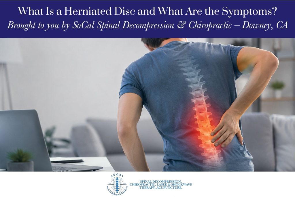 What Is a Herniated Disc and What Are the Symptoms